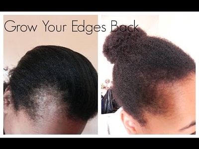 How to Use Jamaican Black Castor Oil to Regrow Your Hair